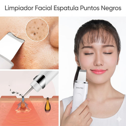 🌸 Removedor de Puntos Negros Ultrasónico | Spa Facial en Casa 💎